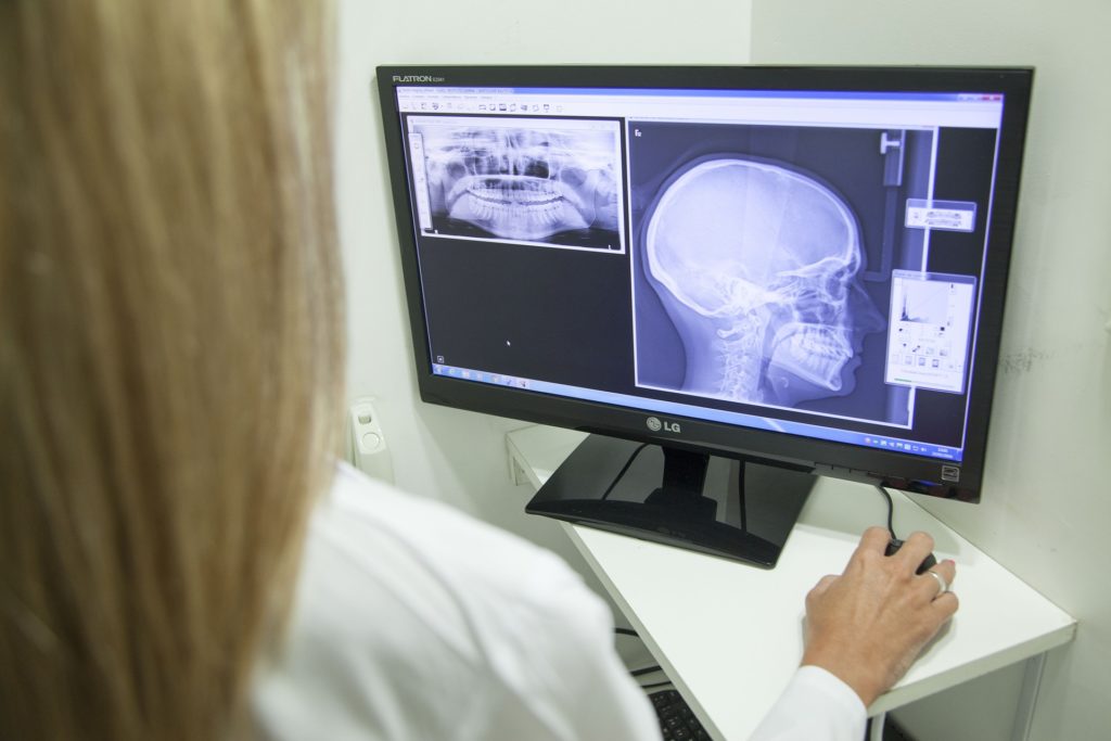 Emprego na Radiologia por Estágio
